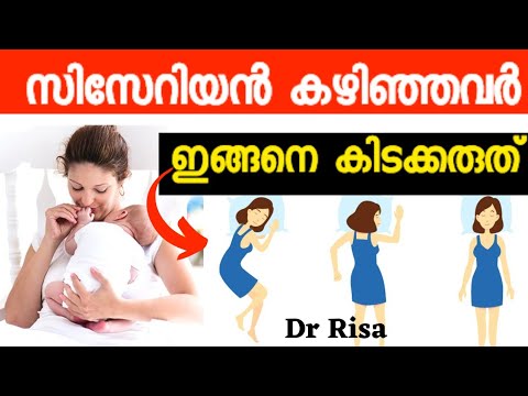 Best Sleep Position After Cesarean|Care After Delivery