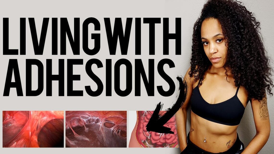 Adhesions | Fighting an Invisible Illness