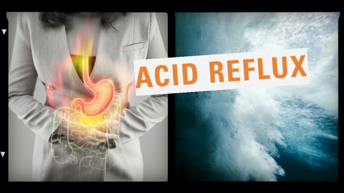 Keeping Pregnant Women Away From Acid Reflux Dilemma