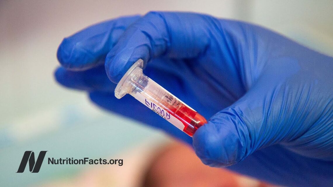 DDT in Umbilical Cord Blood