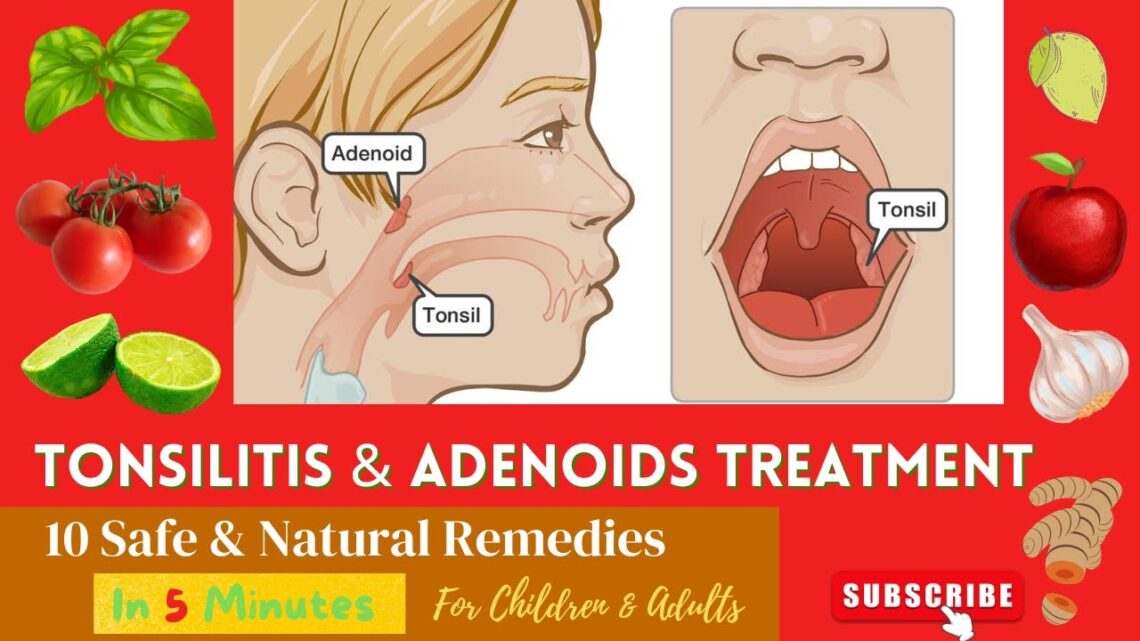 10 Best Effective Proven Home Remedies For Enlarge | Swelling ADENOIDS and TONSILS  In Children