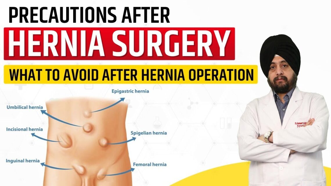 Precautions after Hernia Surgery What to avoid after hernia operation Diet Exercise after hernia