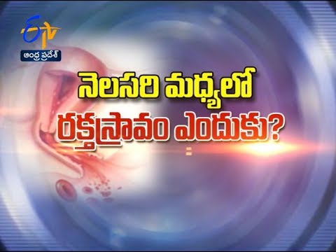 Inter Menstrual Bleeding | Sukhibhava | 27th June 2017 | ETV Andhra Pradesh