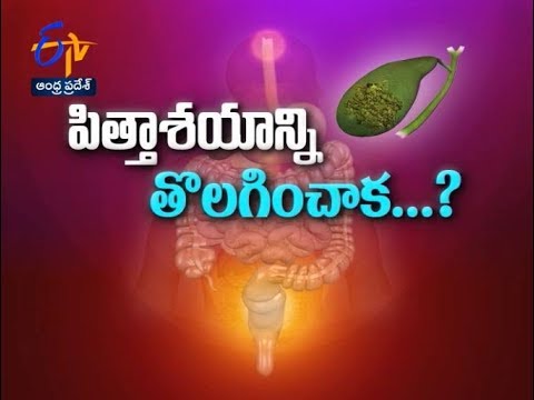 Care After Gall Bladder Removal…Health Tip | Sukhibhava | 3rd August 2018 | ETV AP