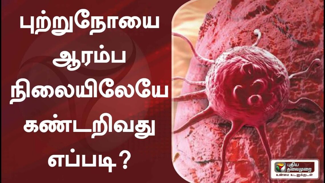 புற்றுநோயை ஆரம்ப நிலையிலேயே கண்டறிவது எப்படி?