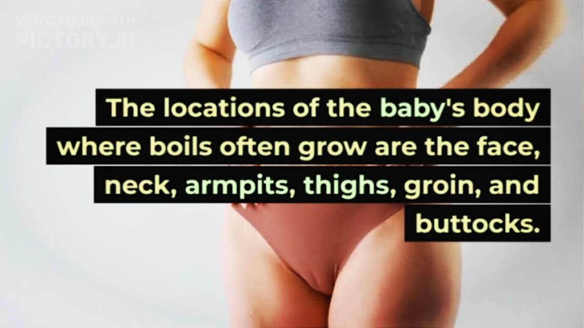 4 Causes of Boils in Babies and How to Overcome Them