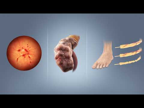 Diabetes mellitus | Wikipedia audio article