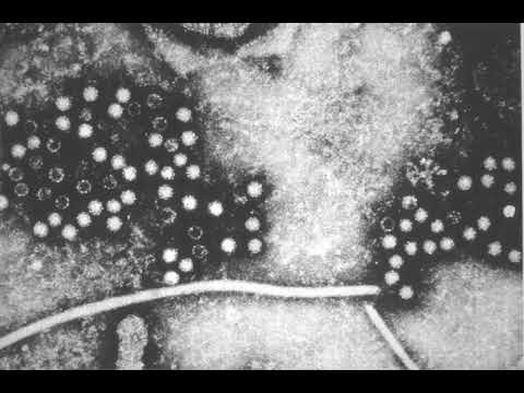 Hepatitis E | Wikipedia audio article