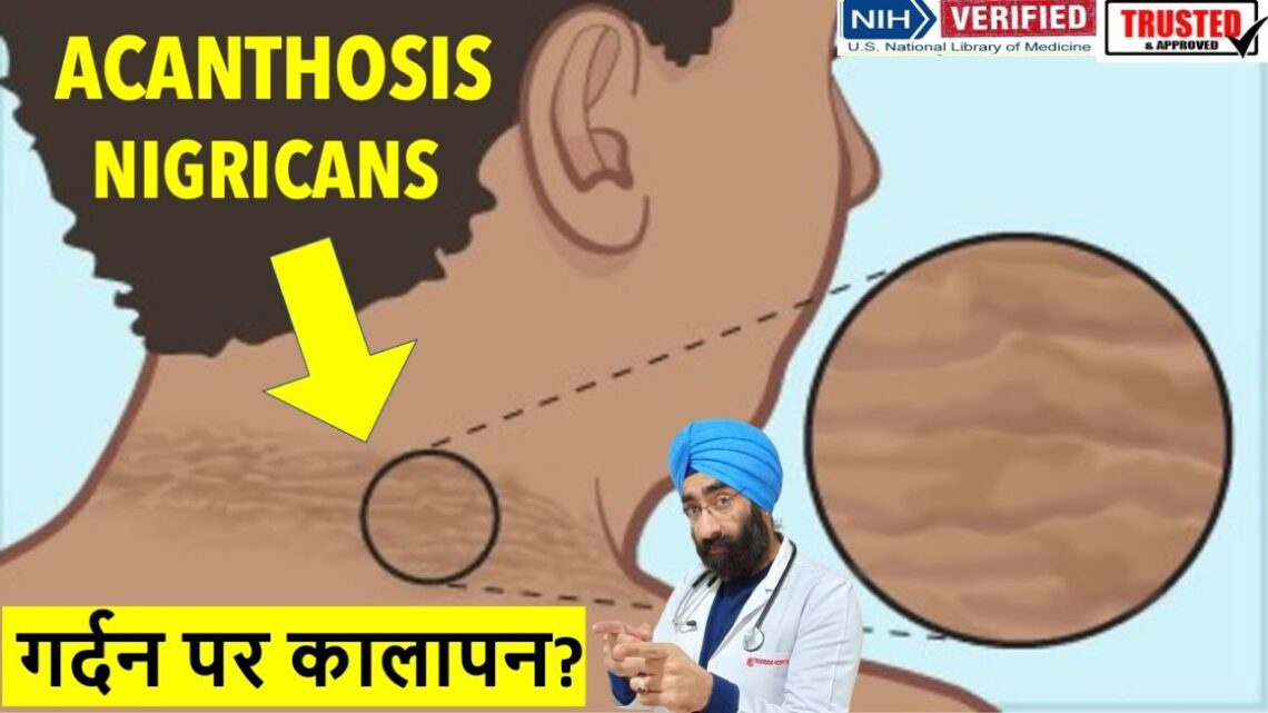 गर्दन पे कालापन | Dark skin around Neck | Acanthosis Nigricans | Dr.Education