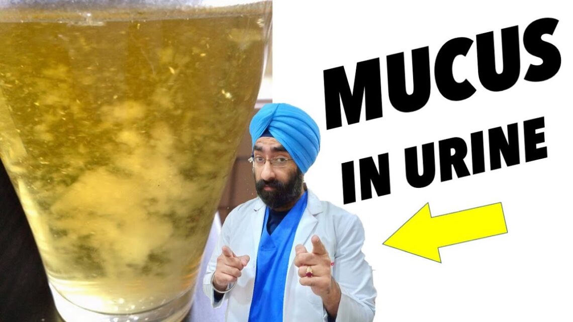 Mucus in Urine | मूत्र में म्यूकस | Dr.Education