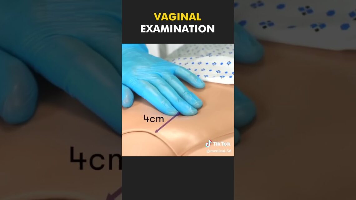 Vaginal Examination Procedure Animation #baby #healthcare #mother