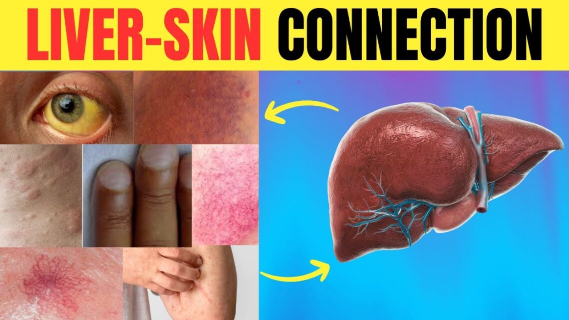 😱 Is Your Skin SCREAMING for Help? 🆘 11 LIVER WARNING Signs You Might Miss! | Longevity Deprocessed