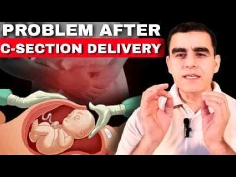 Cesarean Delivery Ke Baad Hone Wali Problems | C Section Complications