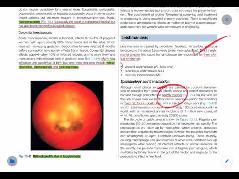 Infectious Disease- Davidson’s Principles and Practice of Medicine | FCPS | MRCP| Lecture-01