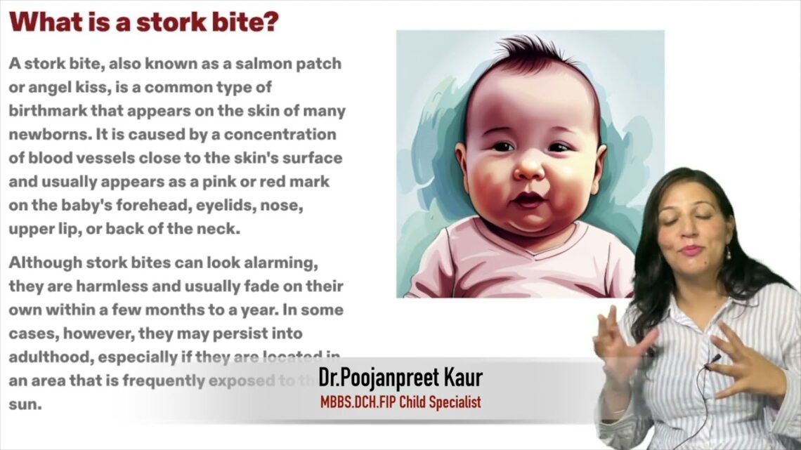 bachon ke skin pe nishaan | dr .Poojanpreet | Dr.Education FAQ