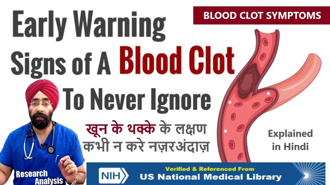 Never Ignore these Symptoms – Early Warning signs of a Blood Clot | Dr.Education (Hindi)