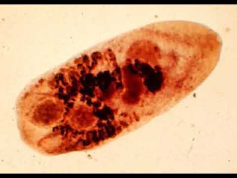 Metagonimiasis | Wikipedia audio article