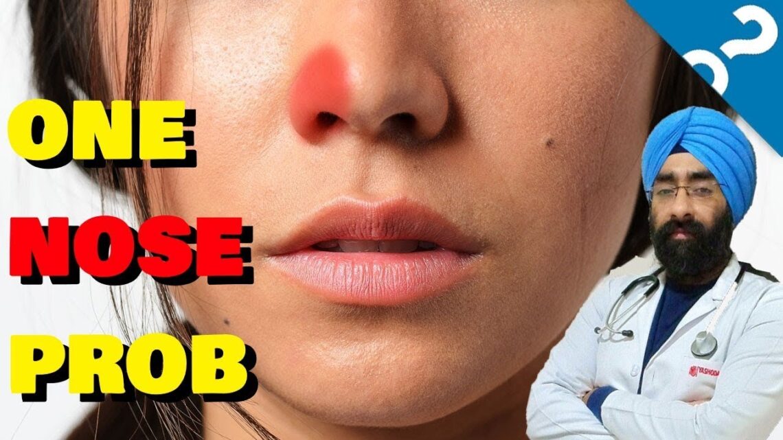 ek naak band? One Side Nose Problem? Single Nostril blocked? Dr.Education (Hindi)