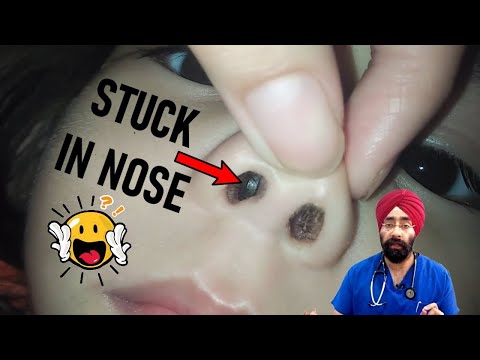 नाक से कोई चीज़ कैसे निकाले | Something Stuck in Nose | How to Remove | Dr.Education