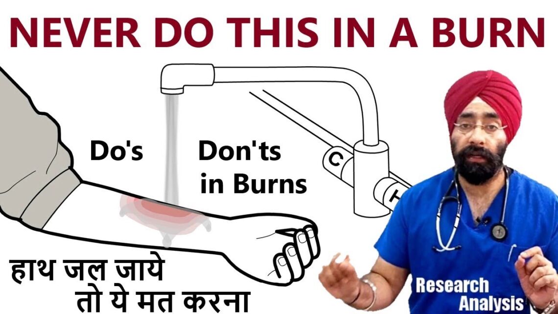 BURN Management | Do’s & Don’ts in Fire Cracker, Hot liquid. Chemical Burns | Dr.Education (Hin+Eng)