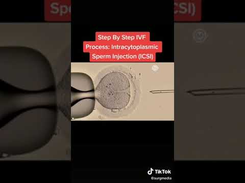 Sperm Injection Procedure in IVF. Test Tube Baby Making Procedure.  #newmom #newborn