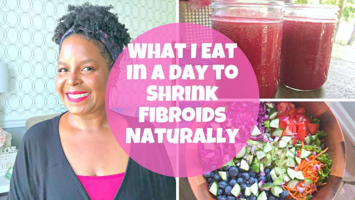 What I Eat in a Day to Shrink Fibroids Naturally Episode 6 | By: What Chelsea Eats