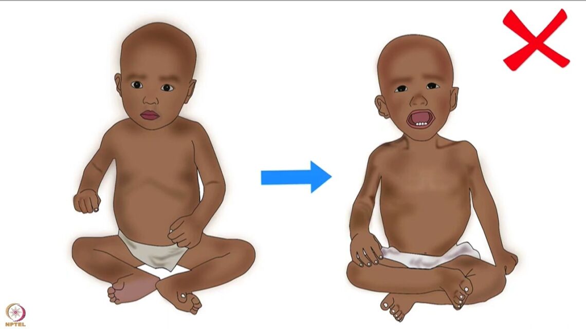 Lecture 56 : Spoken tutorials on WHO weight-for-age and length-for-age percentile growth charts