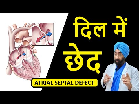 Hole in Heart | दिल में छेद होने से क्या होता है | Atrial Septal Defect | Dr.Education