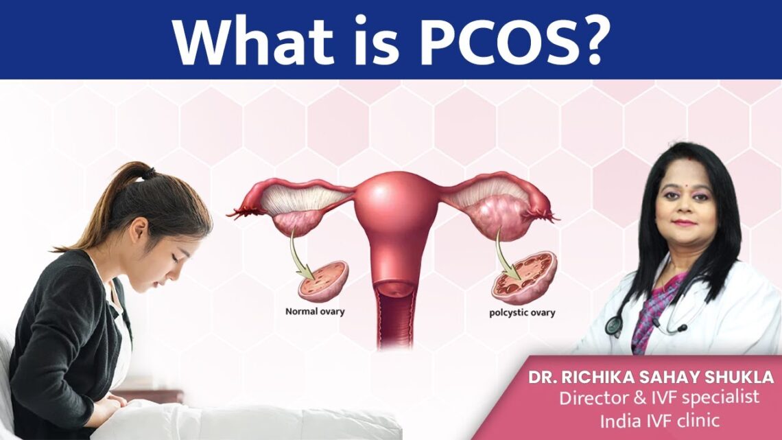 What is PCOS (Polycystic ovary syndrome) Diet Plan? Dr. Richika Sahay Shukla | India IVF Clinic