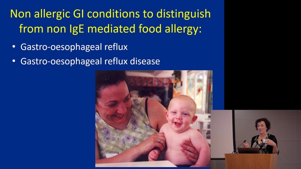 Non-IgE mediated food allergy – Dr Su Bunn