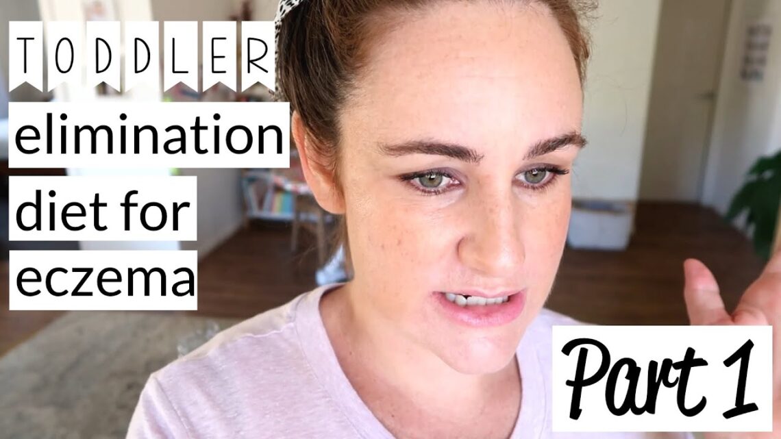 ELIMINATION DIET for TODDLER ECZEMA | Part 1