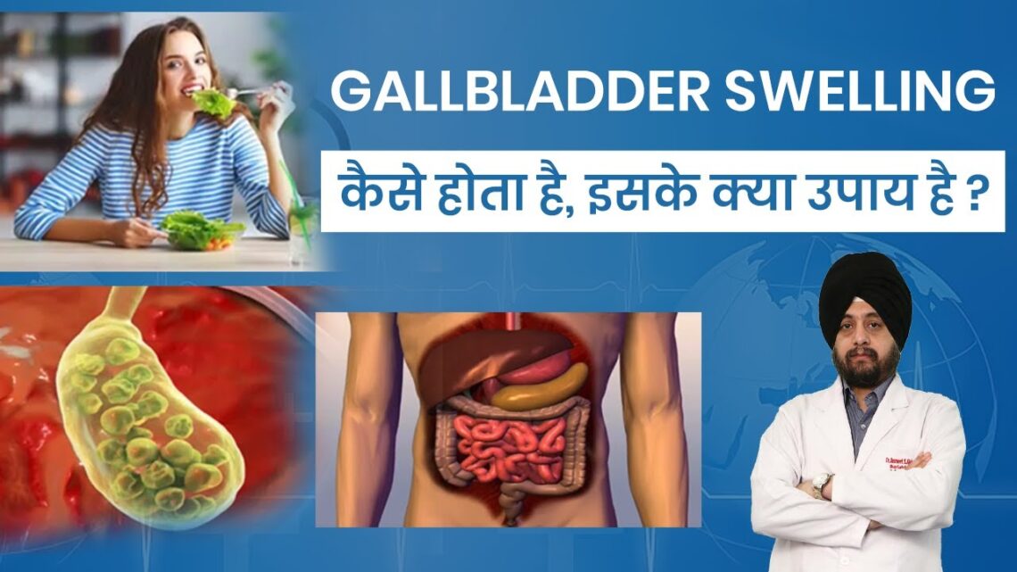 Gallbladder Swelling in Hindi, Causes, Risks, and Treatment Options, पित्ताशय में सूजन के कारण, इलाज