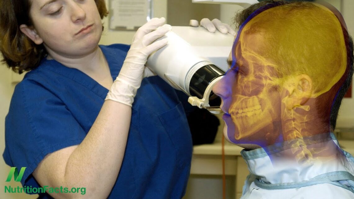 Do Dental X-Rays Cause Brain Tumors?