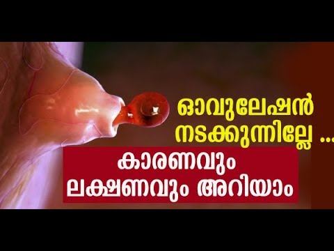 ഓവുലേഷന്‍ നടക്കാതിരുന്നാലുള്ള #ലക്ഷണങ്ങള്‍ #കാരണങ്ങള്‍ #Anovulation and Ovulatory Dysfunction