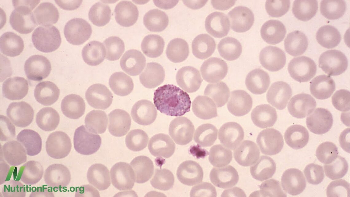 What Does a Low White Blood Cell Count Mean?