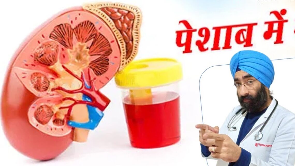 पेशाब में खून | Blood in Urine | RBC in Urine | Dr.Education