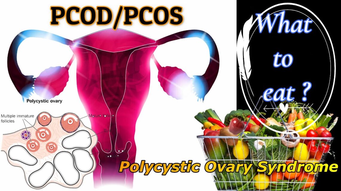 PCOD/PCOS diet: Foods and Lifestyle modification helps to improve ovulation and getting pregnant.