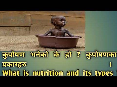 What is Nutrition? what is malnutrition and its type ?पोषण ,कुपोषण र कुपोषणका प्रकारहरु ।